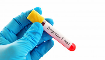 Serum Troponin Testing
