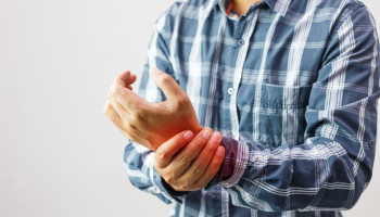 Rheumatoid Arthritis