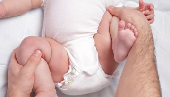 Developmental Dysplasia