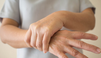 Non-motor Parkinson disease