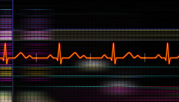 Hyperendemic rheumatic heart disease in a remote Australian town