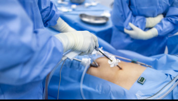 Cholecystectomy for people aged 50 years or more