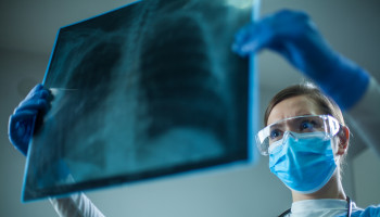 MJA Podcast: The changing landscape of lung cancer in Australia