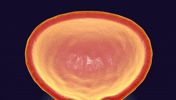 Prostate cancer detection and management