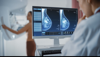 Long term risk of distant metastasis in women with non‐metastatic breast cancer